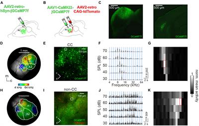 Distinct topographic organization and network activity - Frontiers